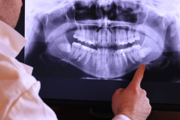 Best Emergency Treatment for Toothache in Riviera Beach, MD