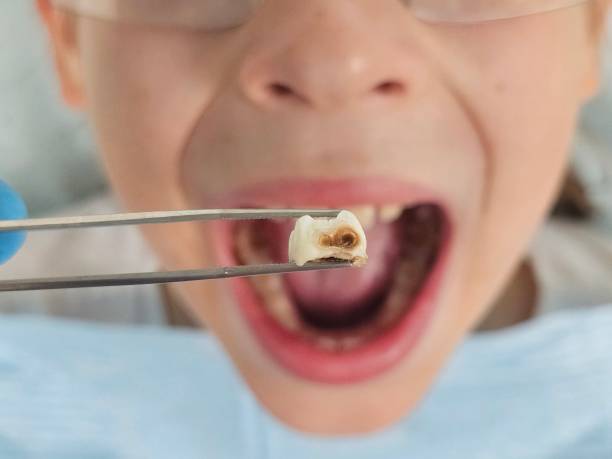 Best Emergency Treatment for Toothache in Riviera Beach, MD